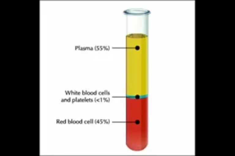 Platelet Rich Plasma (PRP) Therapy Explained