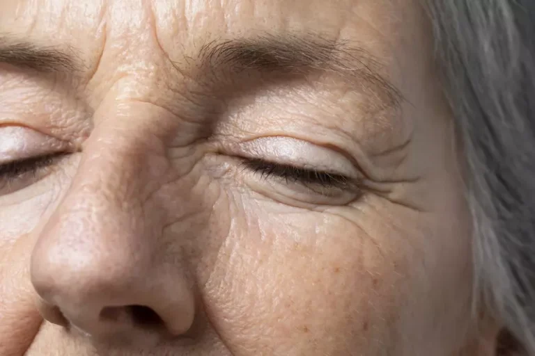 Your Skin Is Aging… Here’s Why