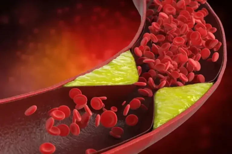 Cholesterol & Particle Testing