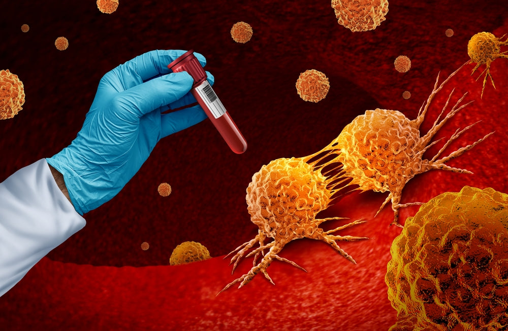 Galleri Test for Early Cancer Detection