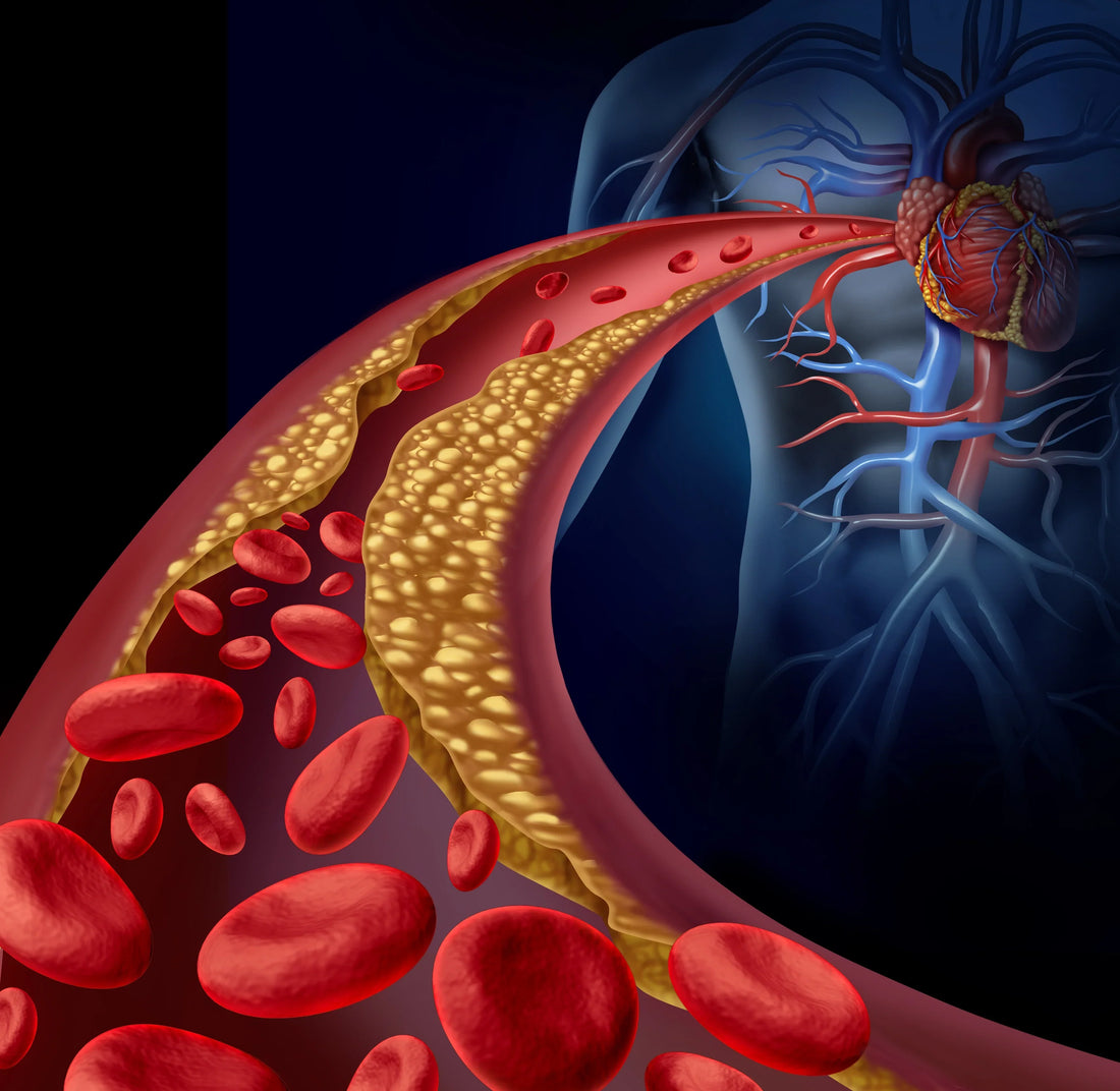 Lipoprotein-Associated Phospholipase A2 (Lp-PLA2)