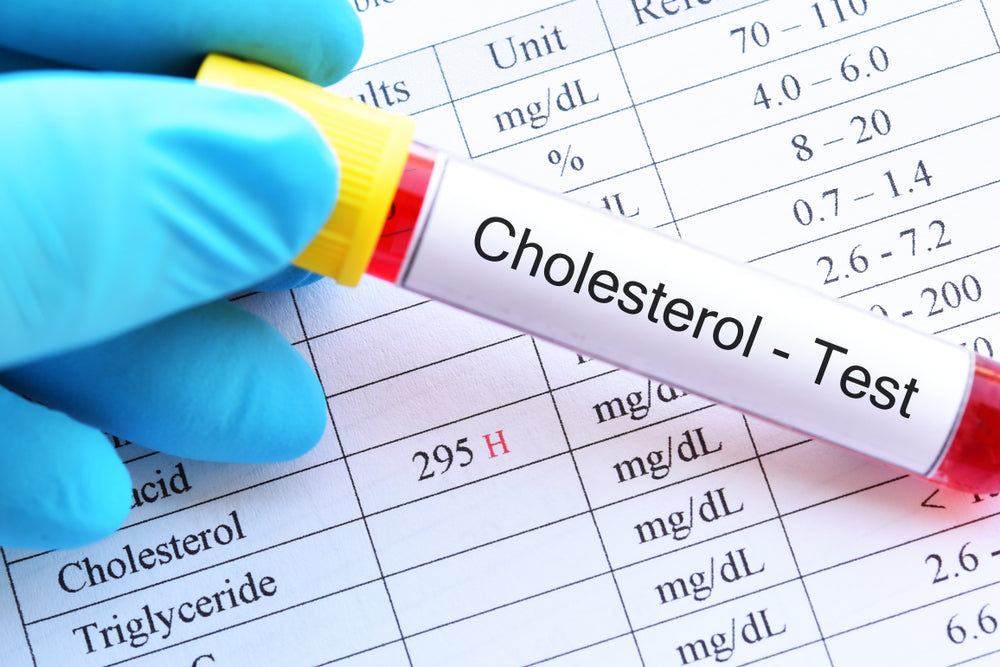 Functional Medicine Approach to Cholesterol