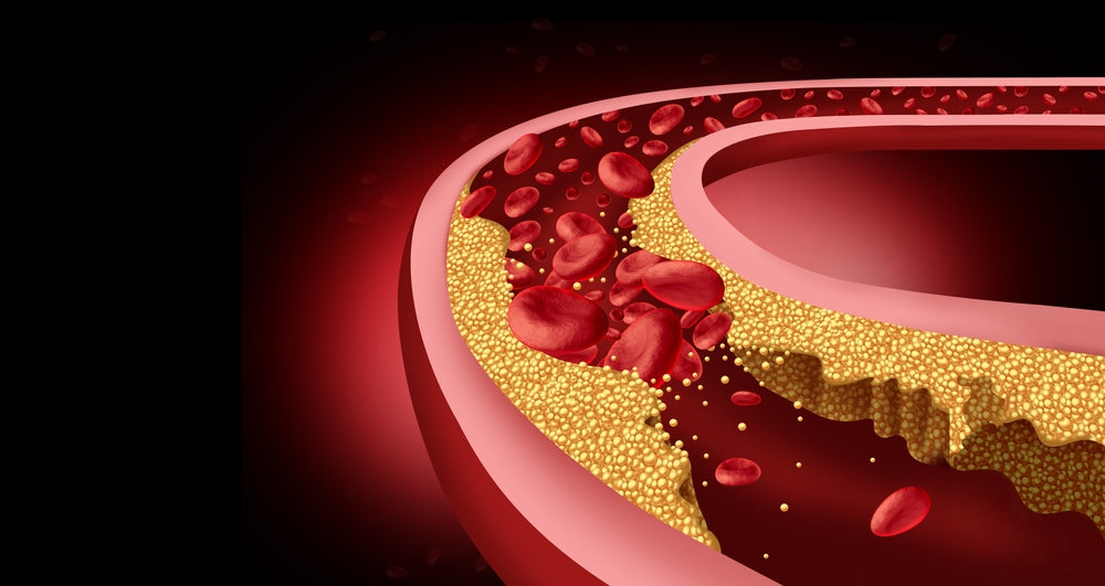 Cholesterol