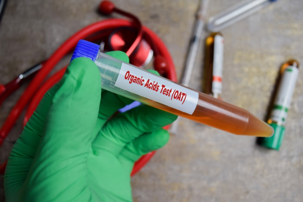 Hormone Testing – Revolution Health & Wellness