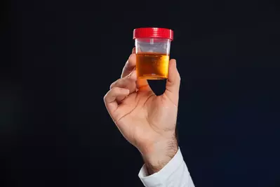 man holding urine sample